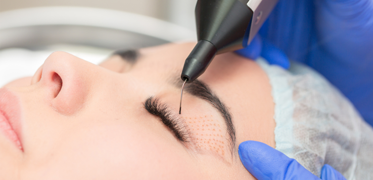 Plexr Plasma Eye Lift Abu Dhabi