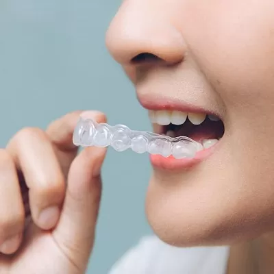 Aligners Abu Dhabi