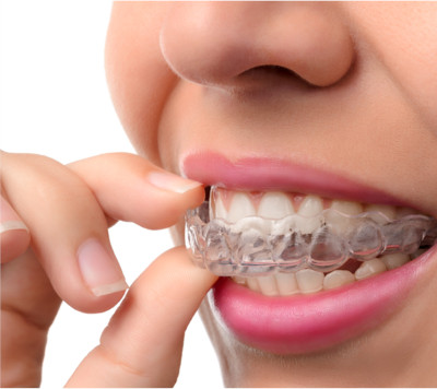 Clear Aligners Abu Dhabi