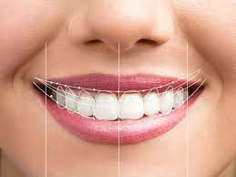 Hollywood Smile Makeover Abu Dhabi 