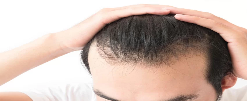 Hybrid Hair Transplant Abu Dhabi