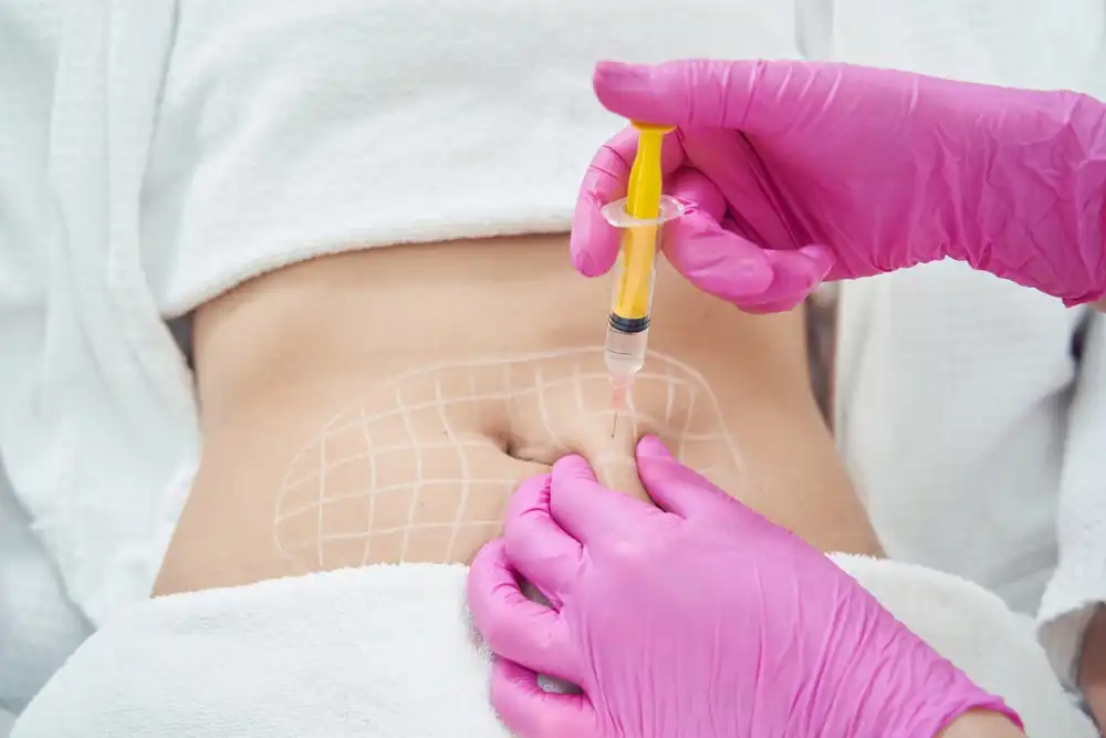 Lipolysis Treatment Abu Dhabi