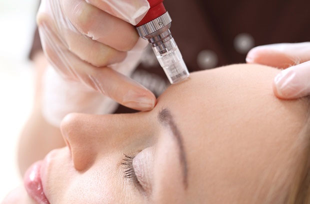 Microneedling Treatment Abu Dhabi