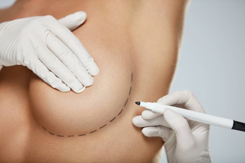 Short Scar Breast Augmentation Abu Dhabi