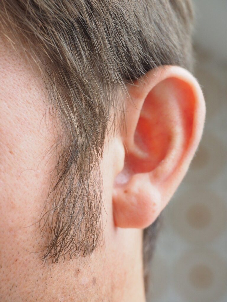 Sideburn Hair Transplant Abu Dhabi